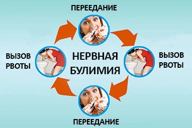 Лечение булимии в Александровском Заводе